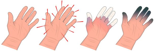 anti-vibration gloves review